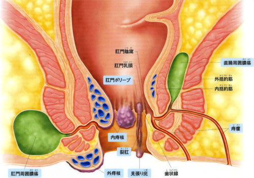 肛門の疾患